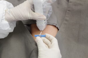 Utilizando o POCUS na implantação de cateter